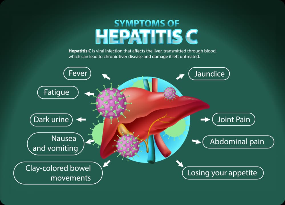 Illustration of liver with labeled symptoms of Hepatitis C, highlighting the importance of early workplace awareness.
