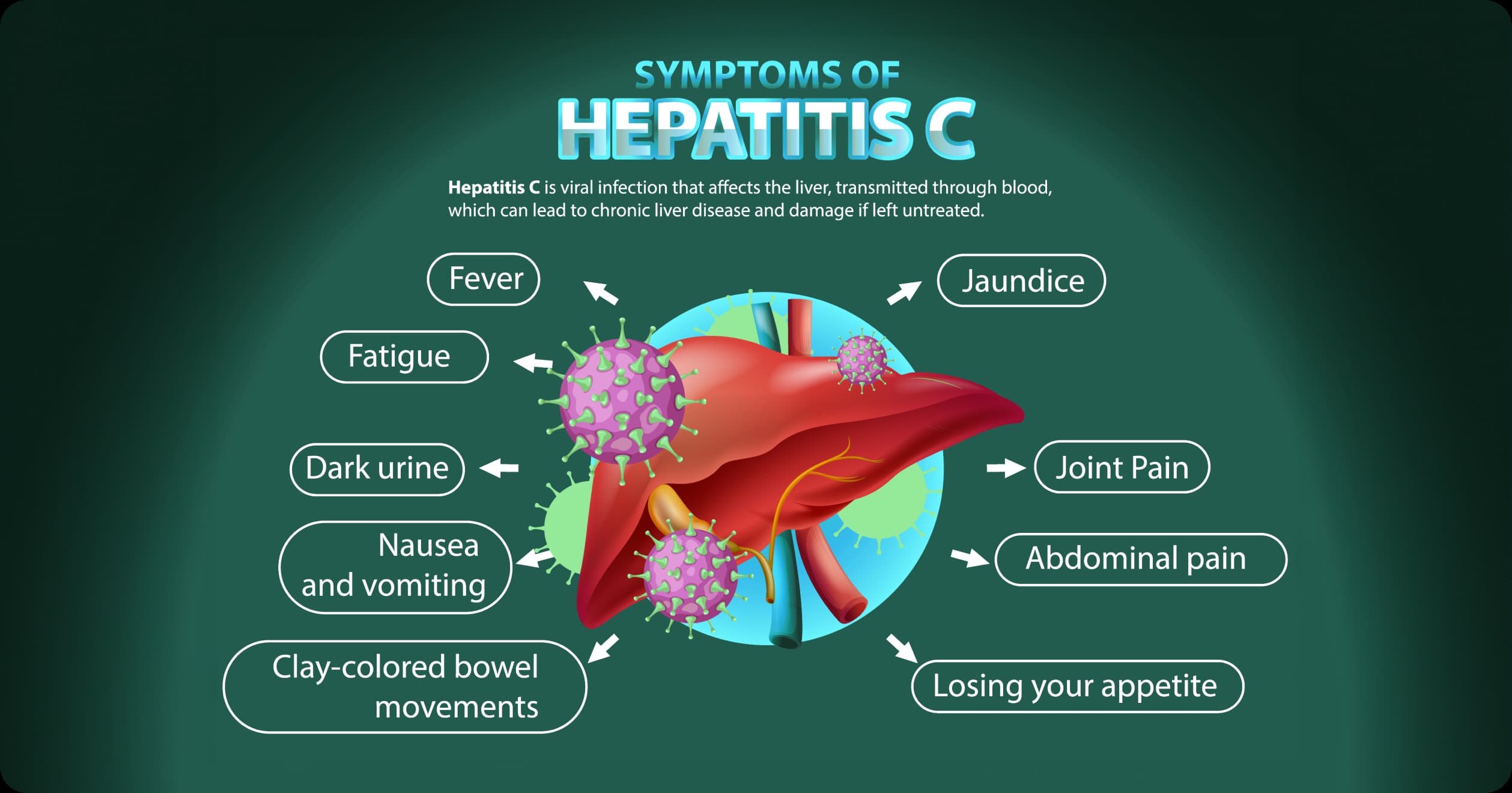 Illustration of liver with labeled symptoms of Hepatitis C, highlighting the importance of early workplace awareness.